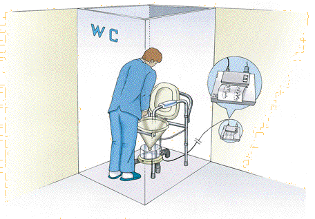 排尿障害の検査　尿流測定について（UFM）